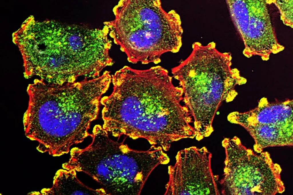 New cancer subtype may illuminate treatment strategy